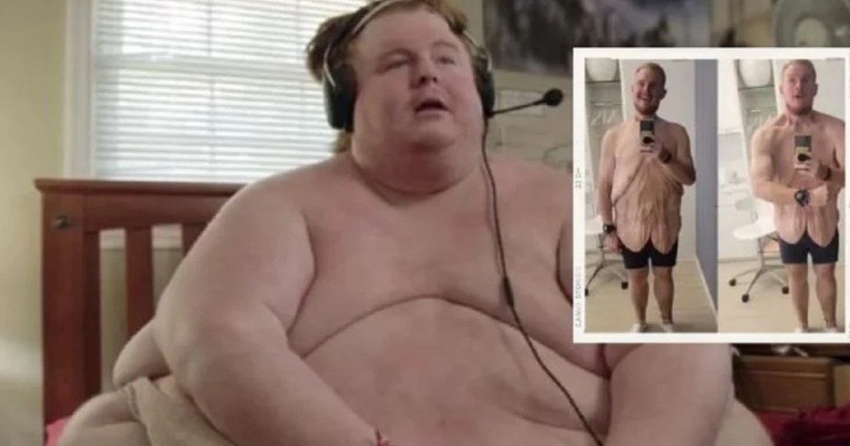 ২৬০ কেজি ওজন কমিয়ে তাক লাগালেন যুবক