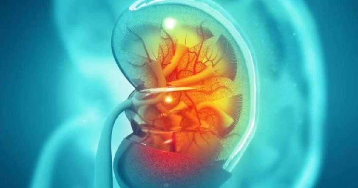 কিডনিতে পাথর থাকলে রোগীকে কী খাওয়াবেন