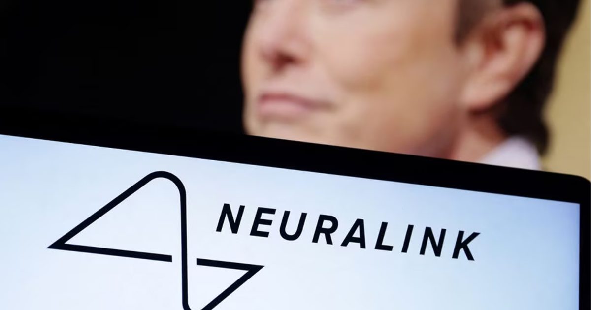 মানবমস্তিষ্কে চিপ বসানোর দিকে আরও এক ধাপ এগোলো ইলন মাস্কের নিউরালিংক