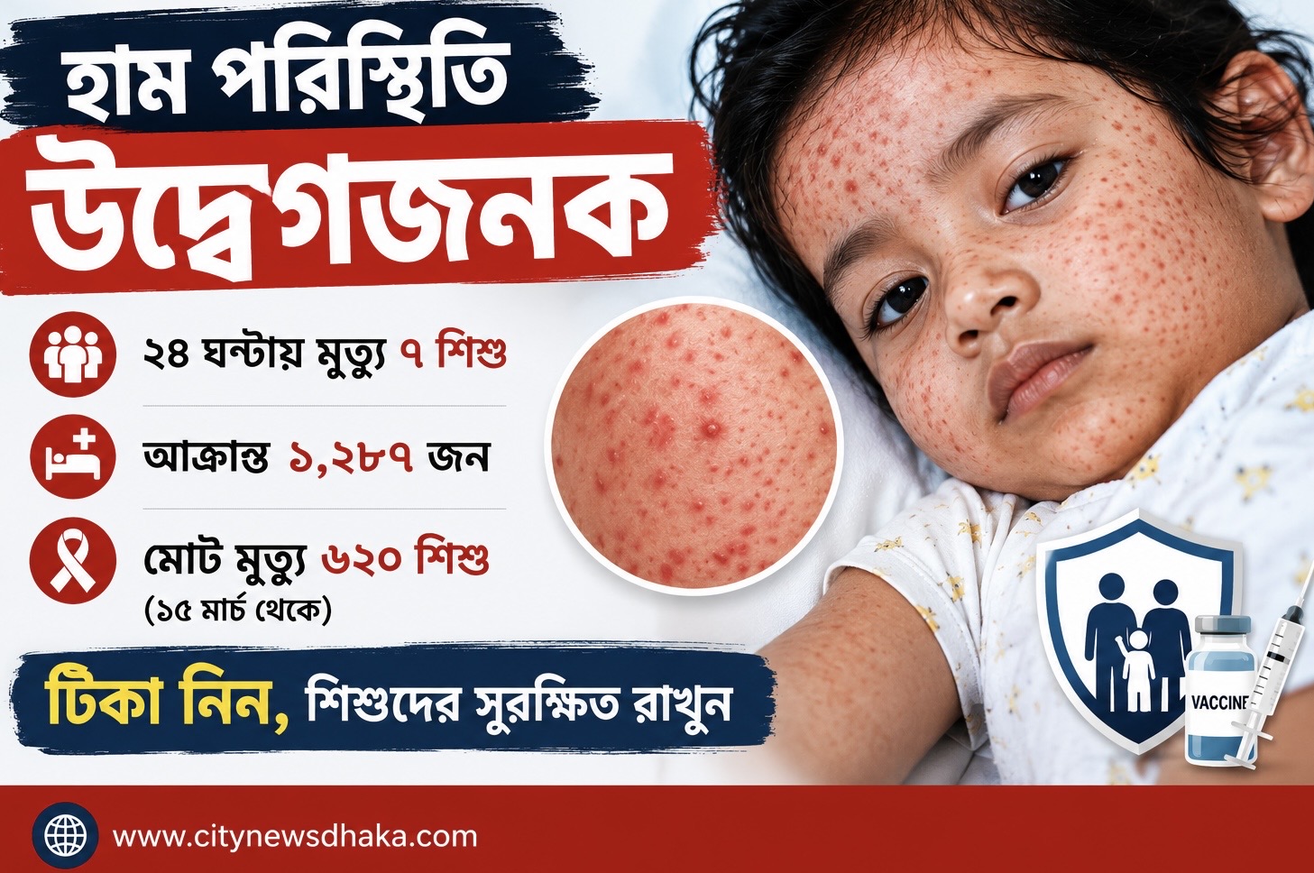 সম্পাদকীয়: হাম মোকাবিলায় আরও জোরালো উদ্যোগের সময় এখনই