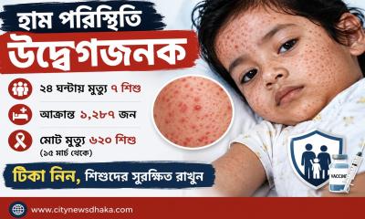 সম্পাদকীয়: হাম মোকাবিলায় আরও জোরালো উদ্যোগের সময় এখনই