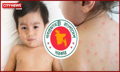 হাম ও উপসর্গে আরও ৪ শিশুর মৃত্যু