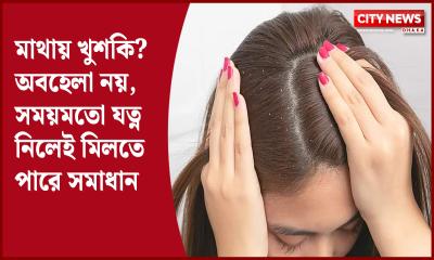 মাথায় খুশকি? অবহেলা নয়, সময়মতো যত্ন নিলেই মিলতে পারে সমাধান