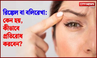 রিঙ্কেল বা বলিরেখা: কেন হয়, কীভাবে প্রতিরোধ করবেন?