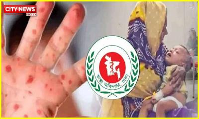 হাম উপসর্গ নিয়ে একদিনে আরও ৮ জনের মৃত্যু