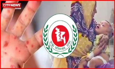 সিলেটে হামের উপসর্গ নিয়ে আরও ৫ শিশুর মৃত্যু