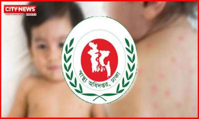 হাম ও উপসর্গে আরও ৫ শিশুর মৃত্যু