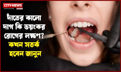 দাঁতের কালো দাগ কি ভয়ংকর রোগের লক্ষণ? কখন সতর্ক হবেন জানুন