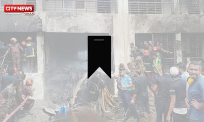 আগুনে পুড়ে যায় মুখ