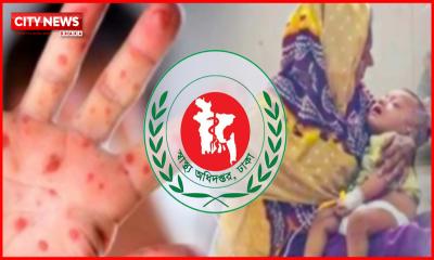 থামছেই না হামের প্রকোপ, একদিনে আরও ৪ প্রাণহানি