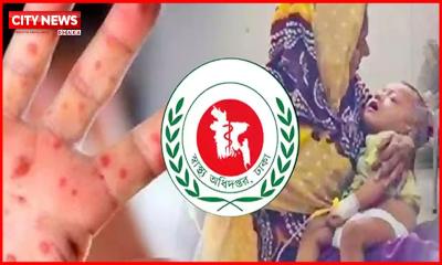 ২৪ ঘণ্টায় হাম ও উপসর্গে আরও ৫ শিশুর মৃত্যু