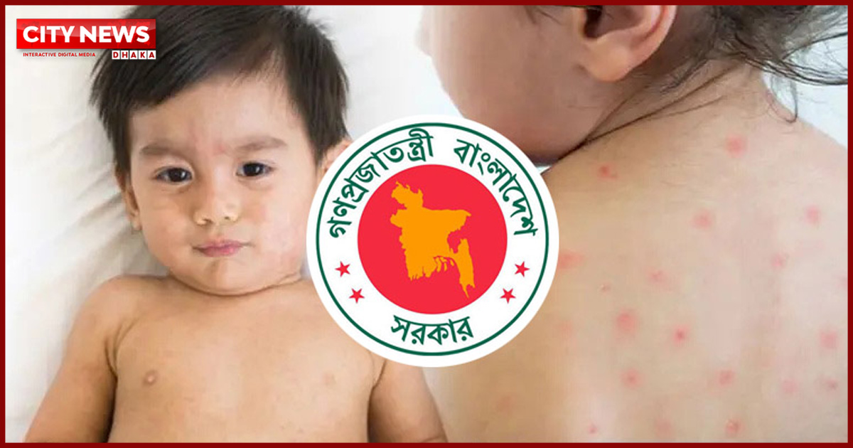 হাম ও উপসর্গে আরও ৪ শিশুর মৃত্যু