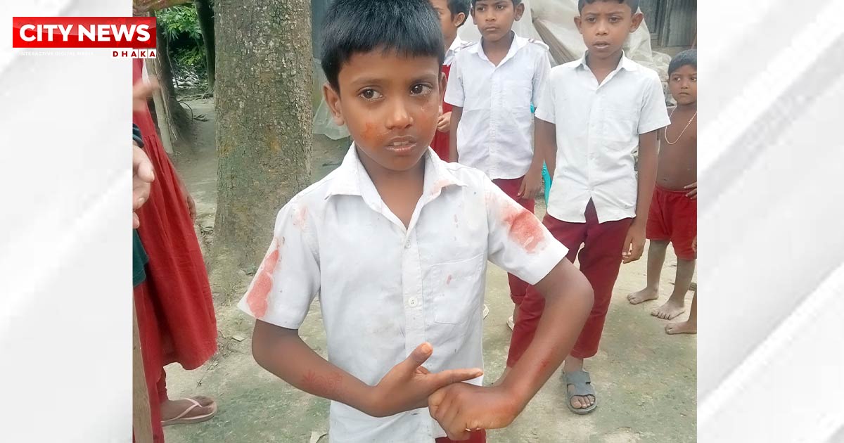 তুচ্ছ ঘটনায় শিশু শিক্ষার্থীর নাক ফাটালেন সহকারি শিক্ষক!