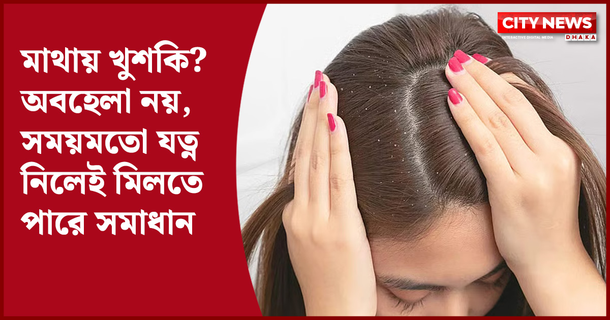 মাথায় খুশকি? অবহেলা নয়, সময়মতো যত্ন নিলেই মিলতে পারে সমাধান