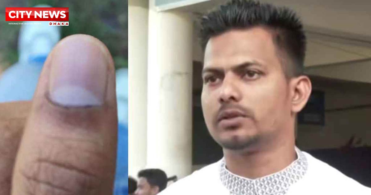 চাকসু নির্বাচন: মুছে যাচ্ছে কালি, অভিযোগ ছাত্রদলের