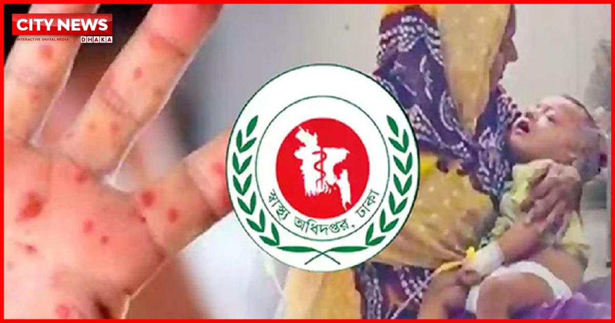 সিলেটে হামের উপসর্গ নিয়ে আরও ৫ শিশুর মৃত্যু