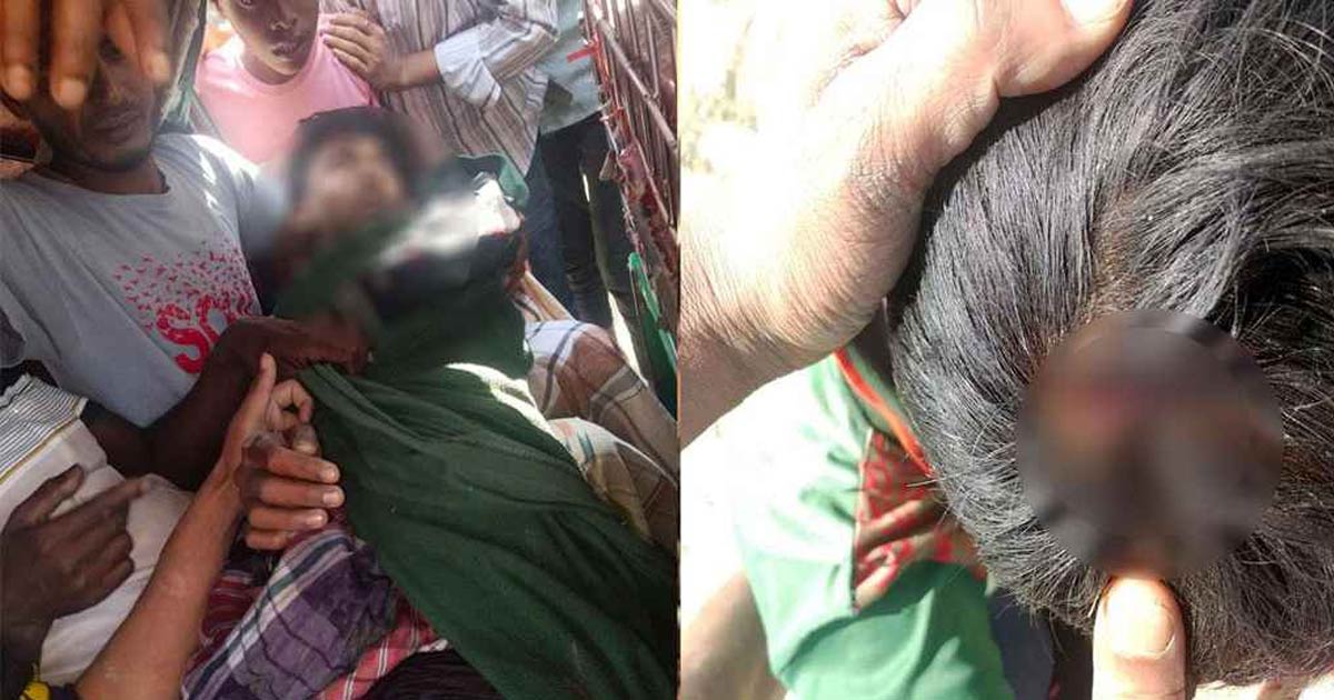 মিয়ানমারে ছোড়া গুলিতে ২ বাংলাদেশি কিশোর আহত