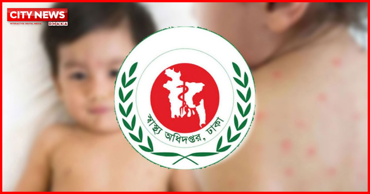 হাম ও উপসর্গে আরও ৫ শিশুর মৃত্যু