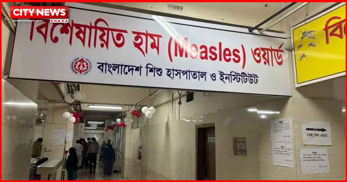 হাম ও হামের উপসর্গে আরও ৭ জনের মৃত্যু