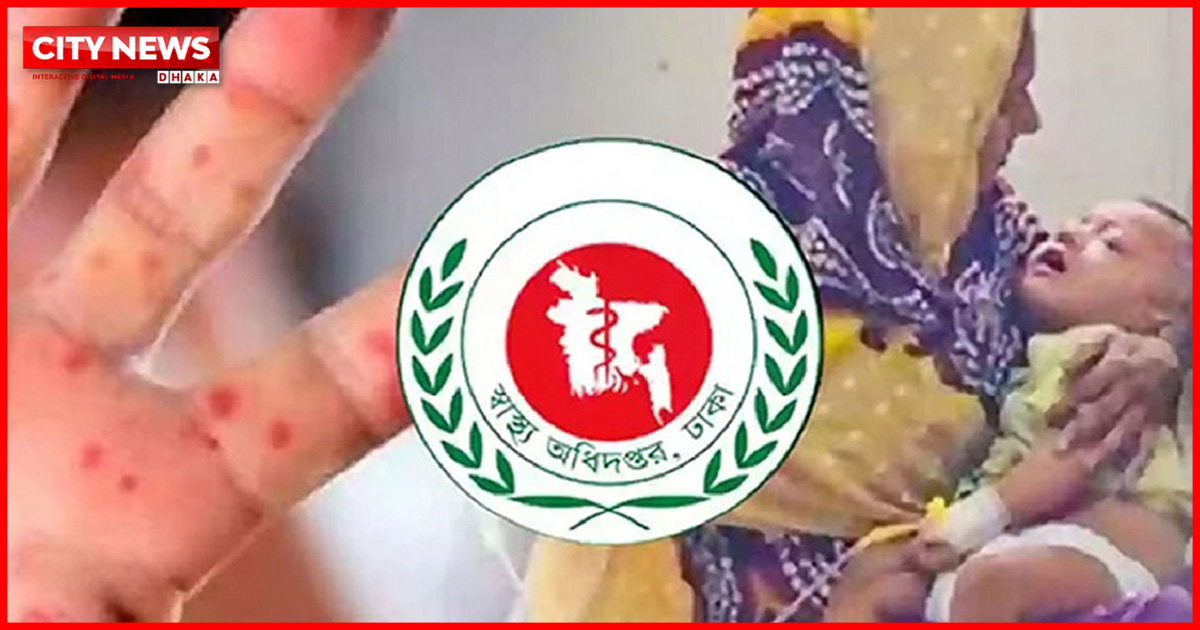 হাম ও উপসর্গে আরও ৩ শিশুর মৃত্যু