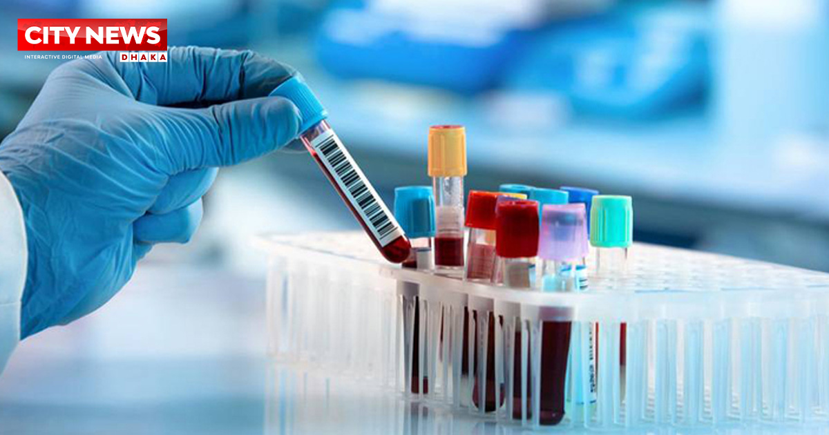 কারাগারে ডোপ টেস্টে শনাক্ত ৮ জন