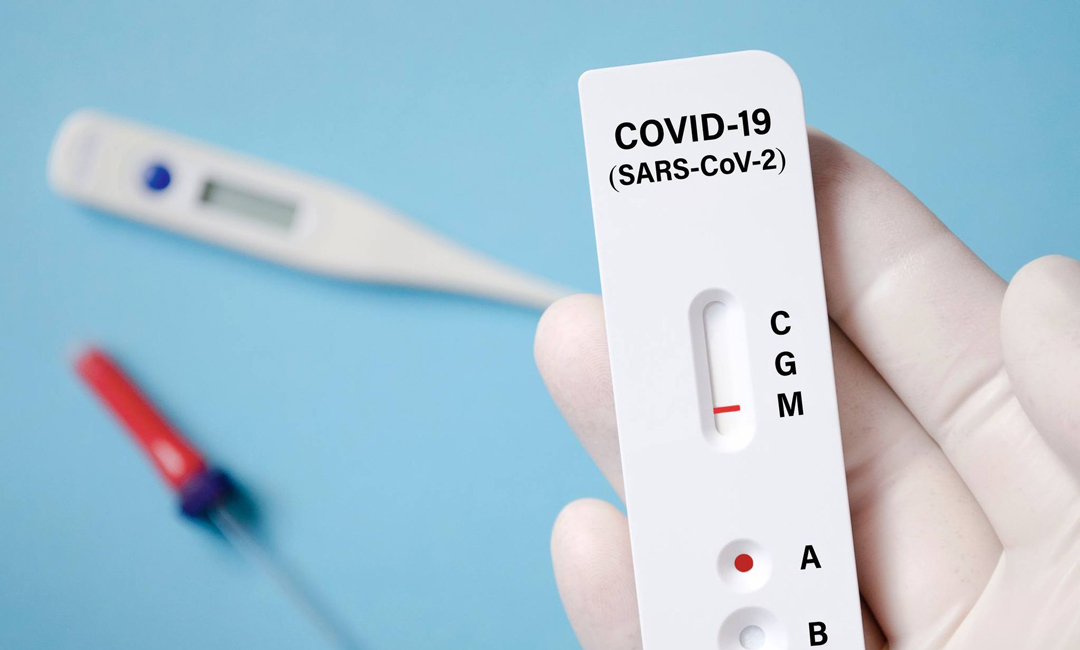 ৭৭ প্রতিষ্ঠান পেল অ্যান্টিজেন টেস্টের অনুমতি