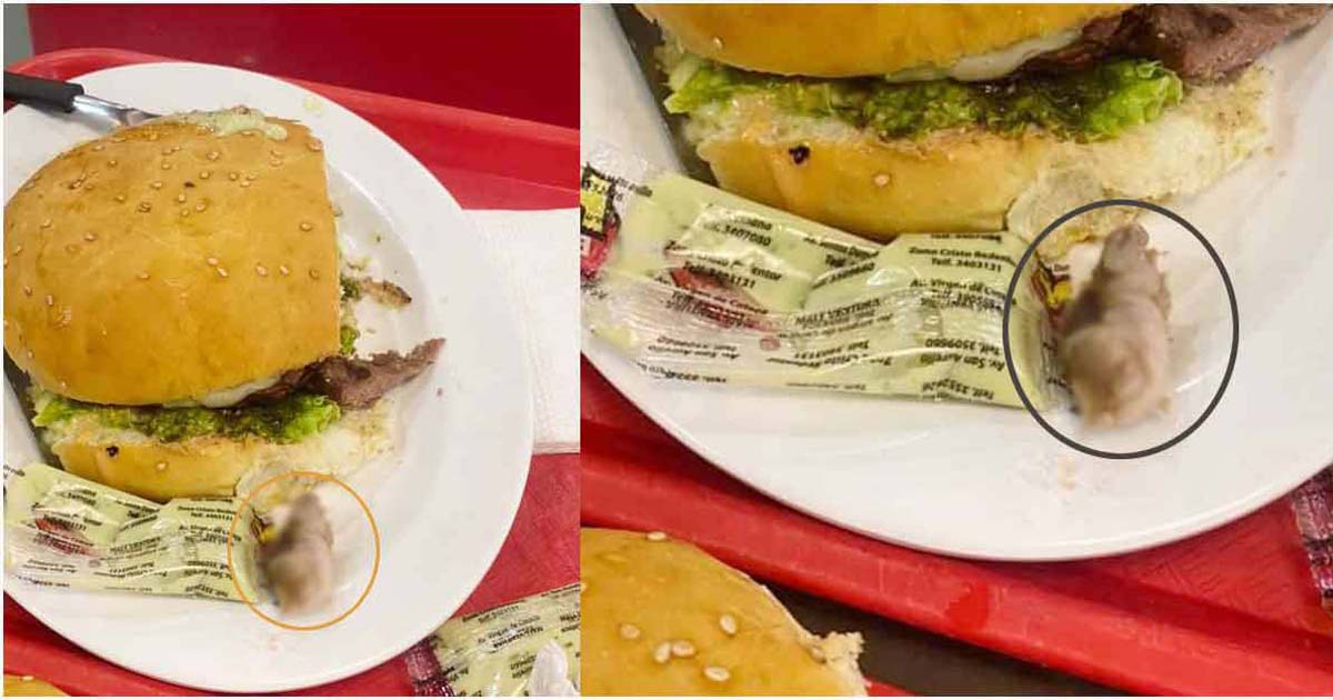 বার্গারে মানুষের কাটা আঙুল!