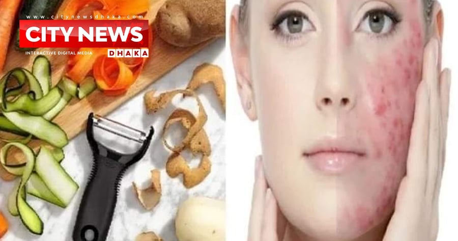 ত্বকের মারাত্মক সব সমস্যার সমাধান মিলবে সবজির খোসাতেই
