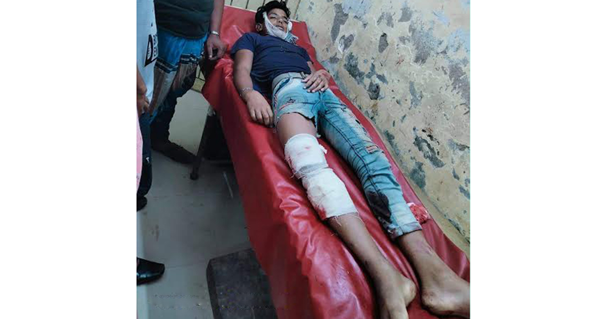 চাটখিলে বাস চাপায় মোটরসাইকেল আরোহী নিহত