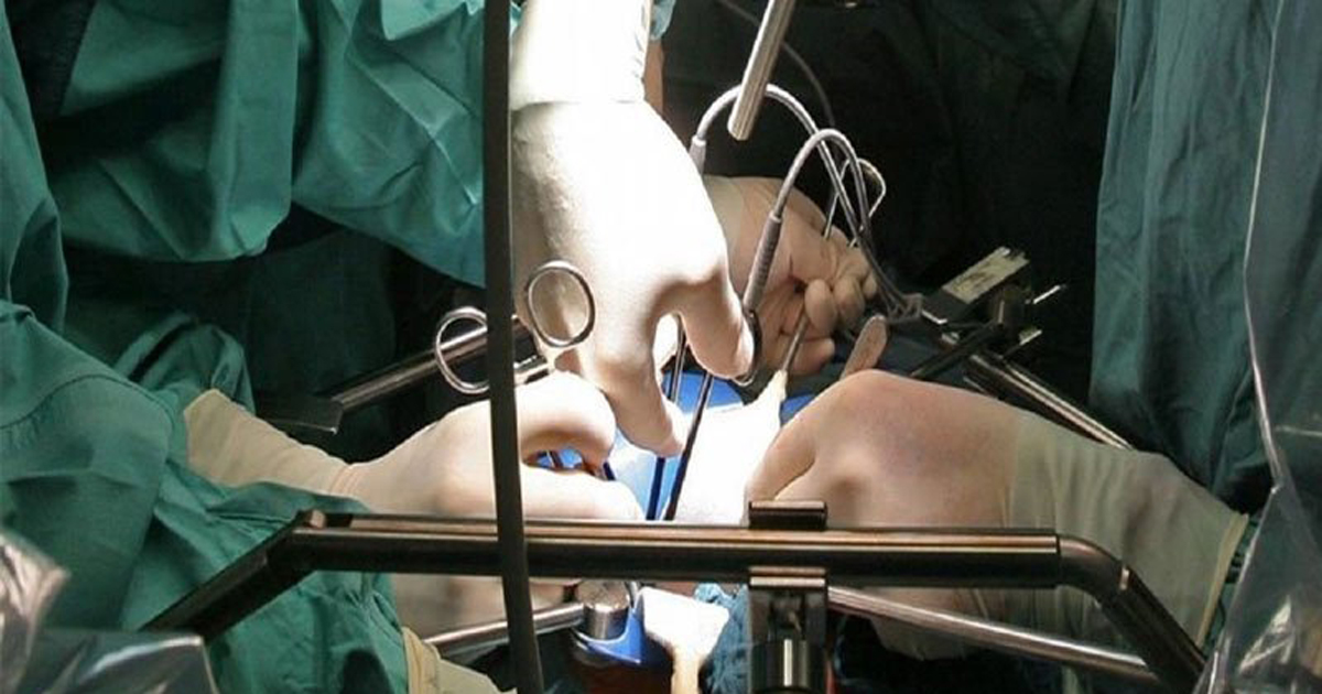 পাথরের বদলে কিডনি ফেলে দেন ডাক্তার