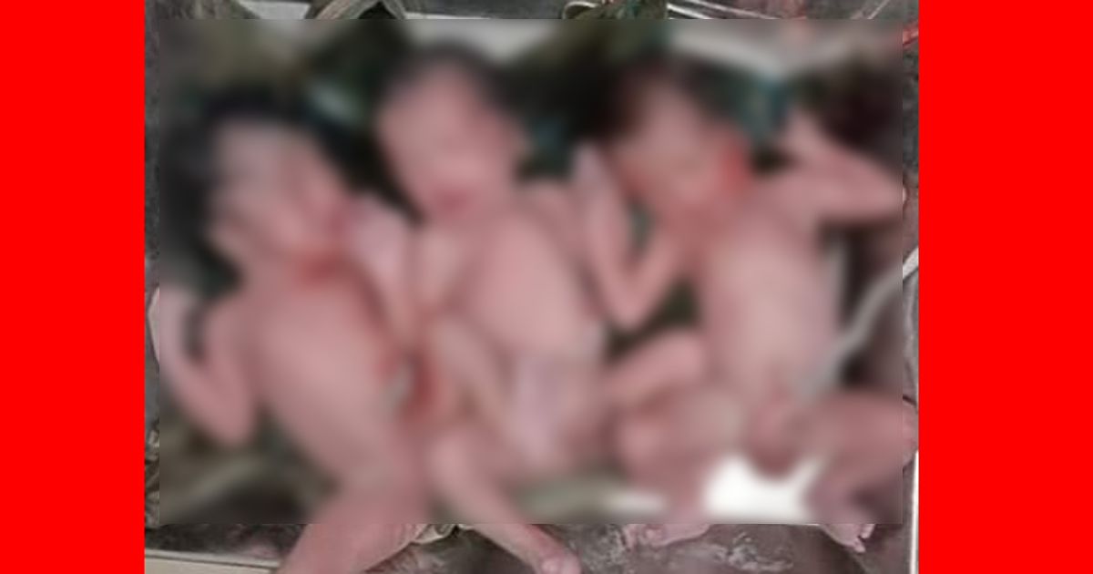 নাটোরে একসঙ্গে ৩ শিশুর জন্ম