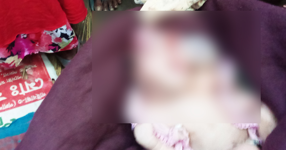 সাদুল্লাপুরে অদ্ভুত আকৃতির শিশুর জন্ম