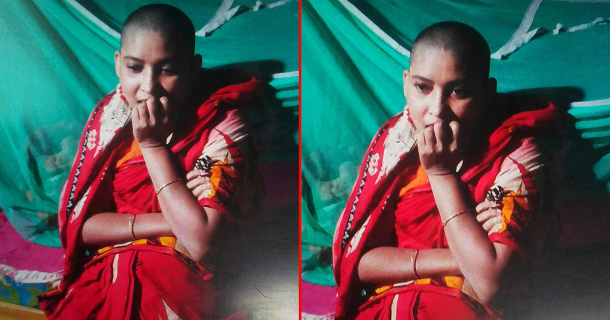 তেল না পাওয়ায় মাথা ন্যাড়া করে প্রতিবাদ গৃহবধূর