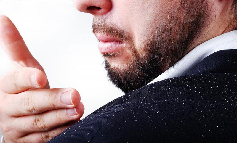 শীতে খুশকির সমস্যায় করণীয়