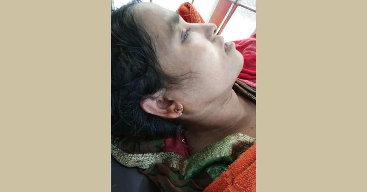 বিজয়ী নারী সদস্যের ওপর পরাজিত প্রার্থীর হামলা