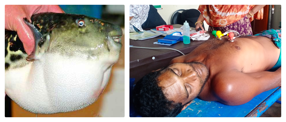 পিরোজপুরে পটকা মাছ খেয়ে দুই জেলের মৃত্যু