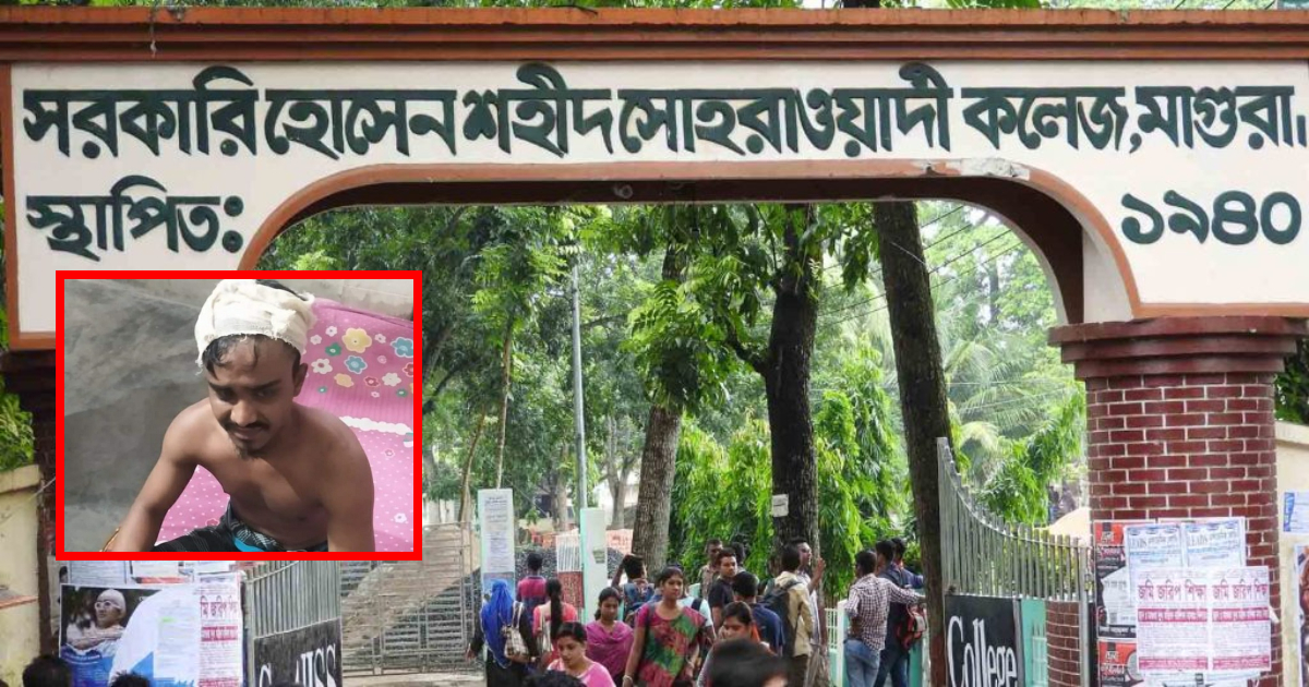 ছাত্রদলের মিছিলে ছাত্রলীগের হামলা,আহবায়ক মারাত্মক আহত