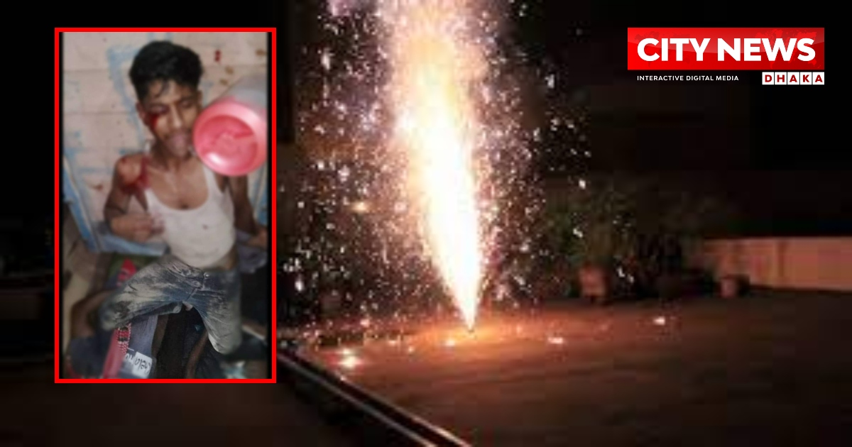 আতশবাজির আগুনে ঝলসে গেল যুবকের হাত ও চোখ