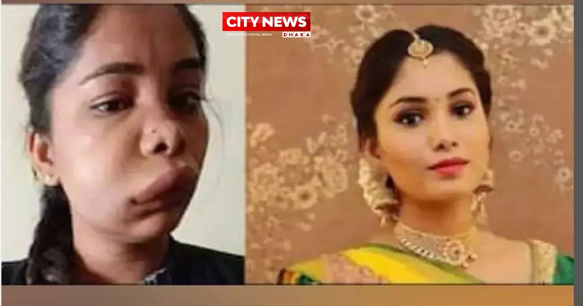 দাঁতের ভুল চিকিৎসায় অভিনেত্রীর সর্বনাশ