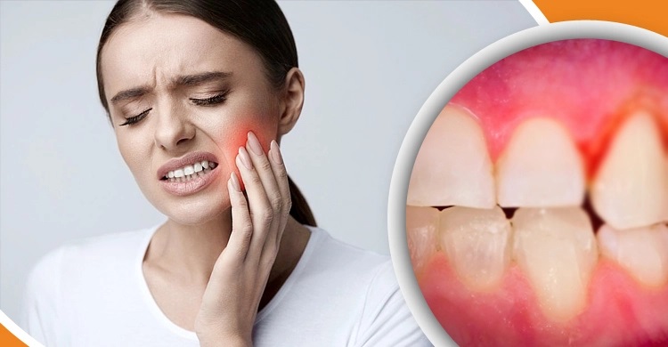 দাঁতের মাড়ি ফুলে যাওয়ার কারণ ও প্রতিকার