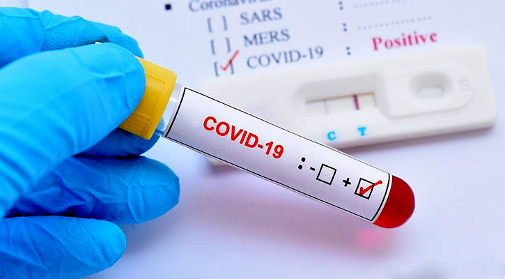 কোয়ারেন্টিন শেষে বাড়ি ফেরা দম্পতির করোনা