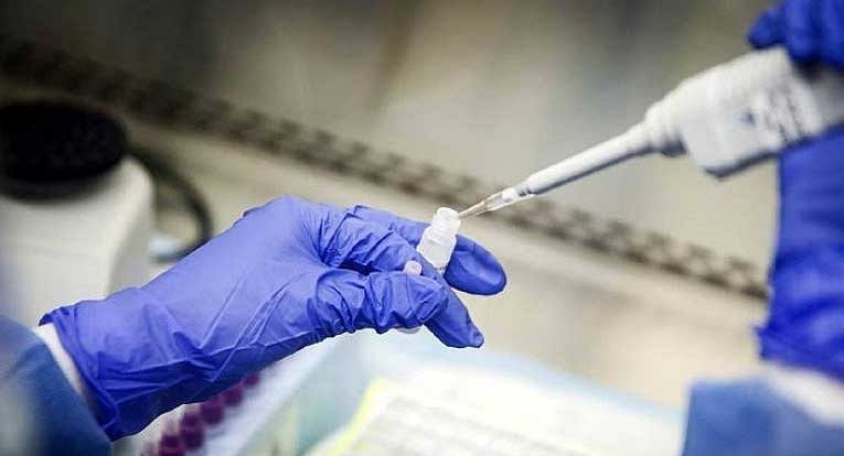 ১ সেকেন্ডে করোনা শনাক্তের কিট আবিষ্কার