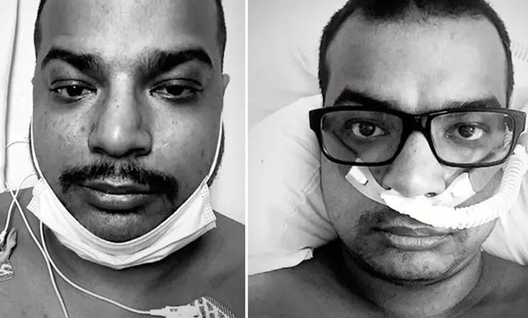 টিকা নিয়ে ব্যঙ্গকারীর মৃত্যু করোনায়