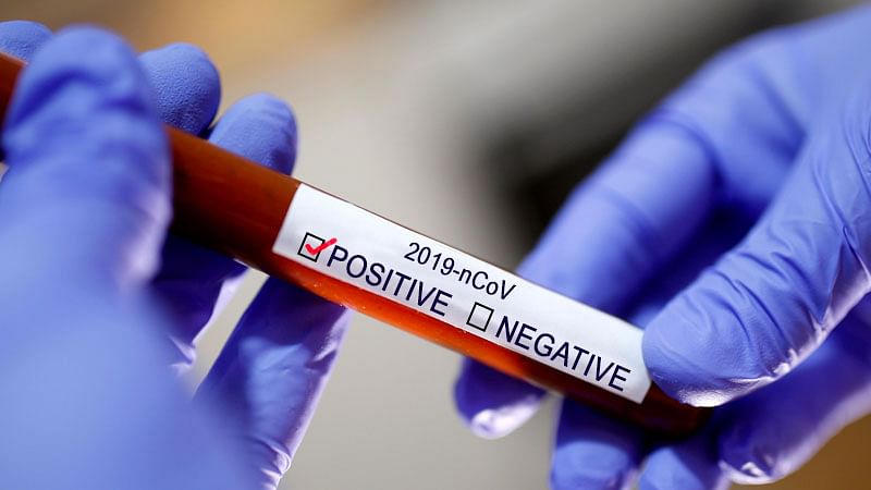 মাগুরায় ভারতফেরত একজনের করোনা শনাক্ত