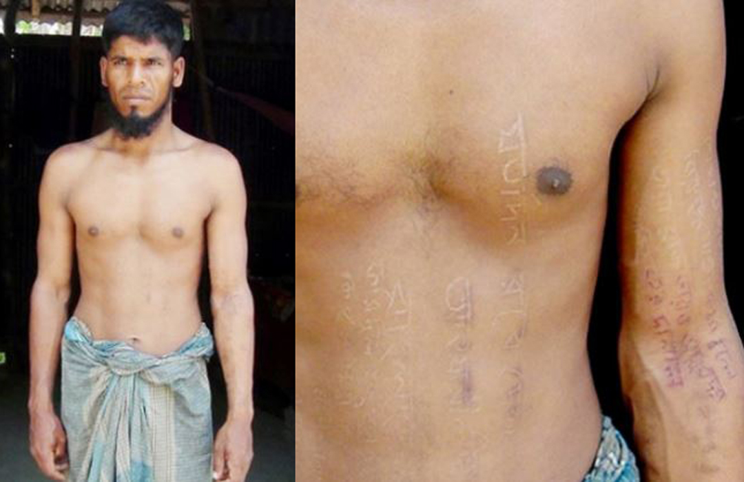 শরীর কেটে বঙ্গবন্ধু ও প্রধানমন্ত্রীর নাম লিখল দিনমজুর